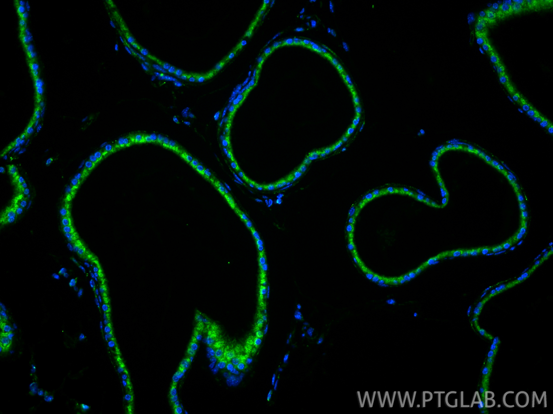 Immunofluorescence (IF) / fluorescent staining of mouse prostate tissue using KLK3/PSA Polyclonal antibody (10679-1-AP)