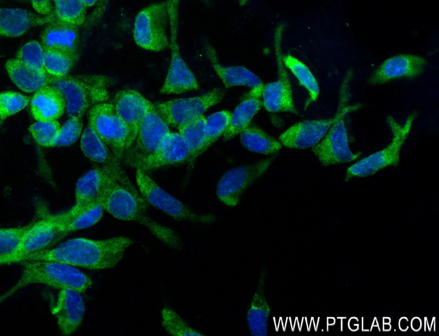 Immunofluorescence (IF) / fluorescent staining of LNCaP cells using KLK3/PSA Recombinant antibody (84059-5-RR)