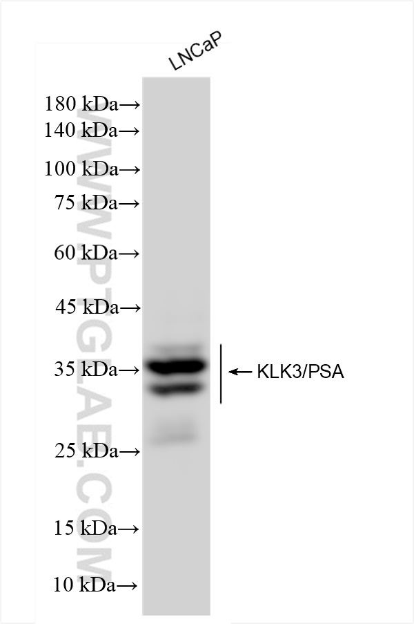 Western Blot (WB) analysis of LNCaP cells using KLK3/PSA Recombinant antibody (84059-5-RR)