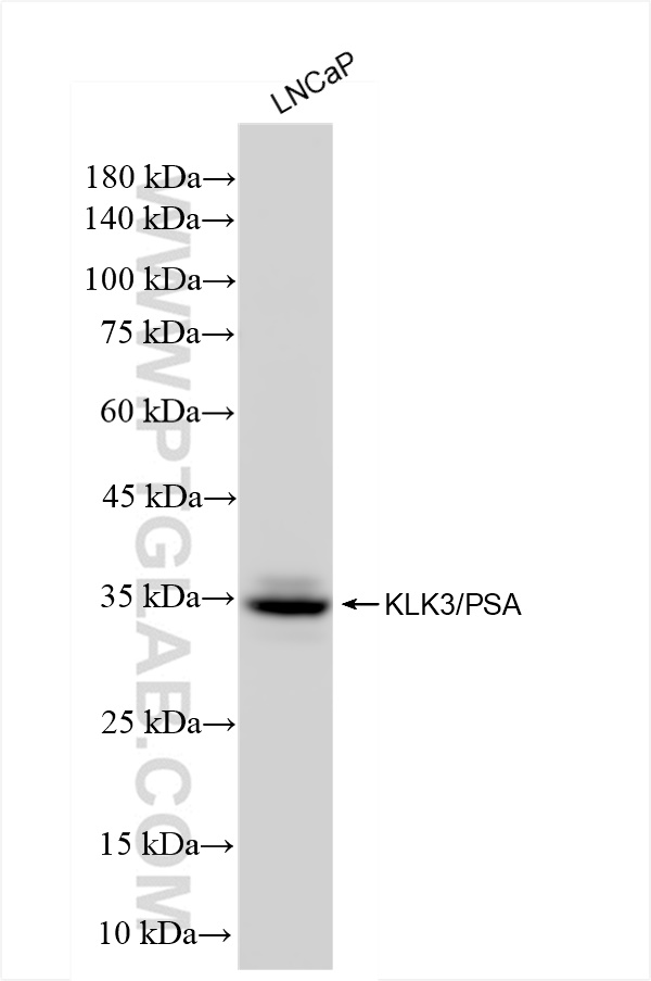 Western Blot (WB) analysis of LNCaP cells using KLK3/PSA Recombinant antibody (84059-6-RR)