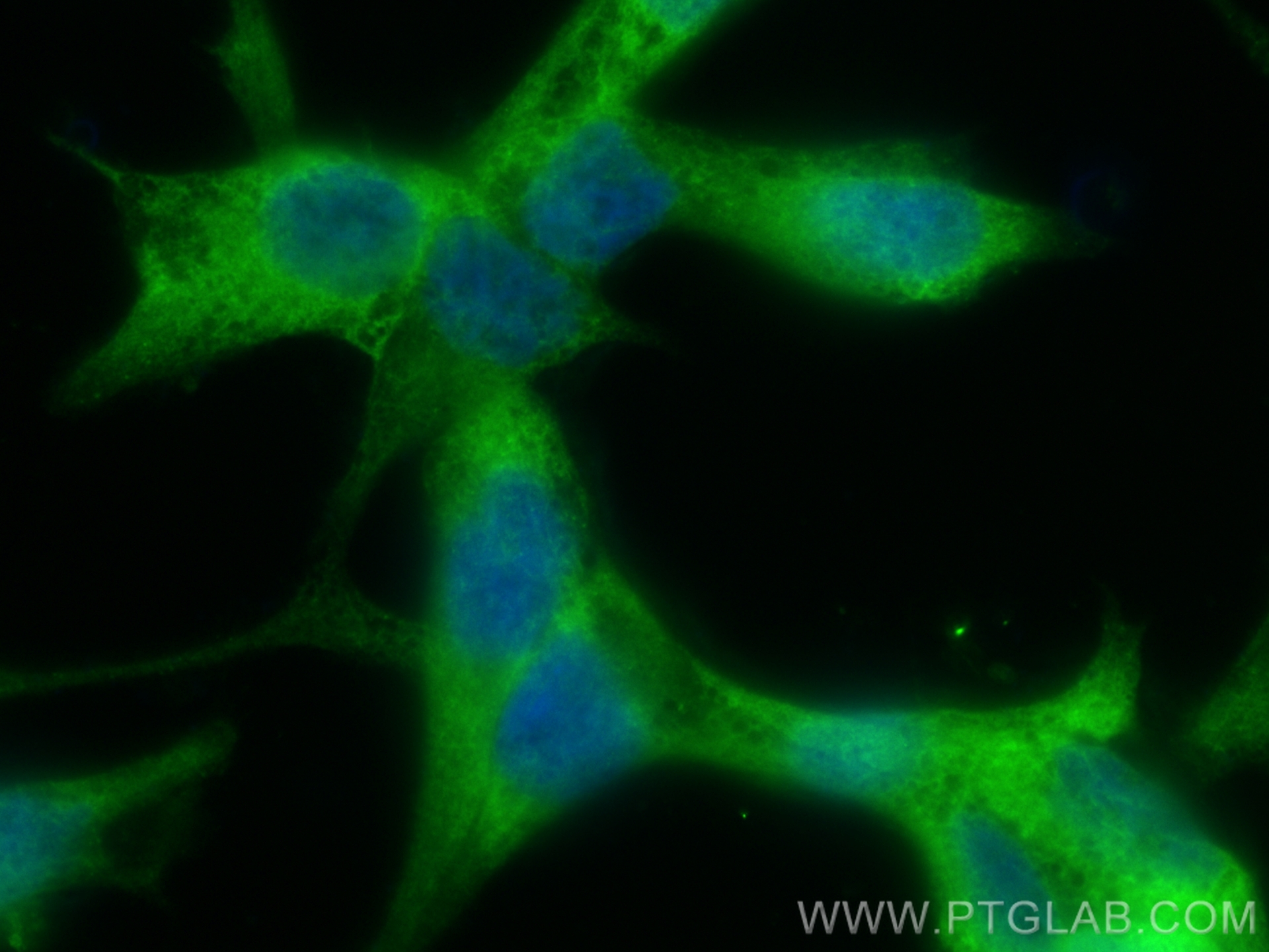 Immunofluorescence (IF) / fluorescent staining of LNCaP cells using CoraLite® Plus 488-conjugated KLK3/PSA Recombinant (CL488-84059-5)