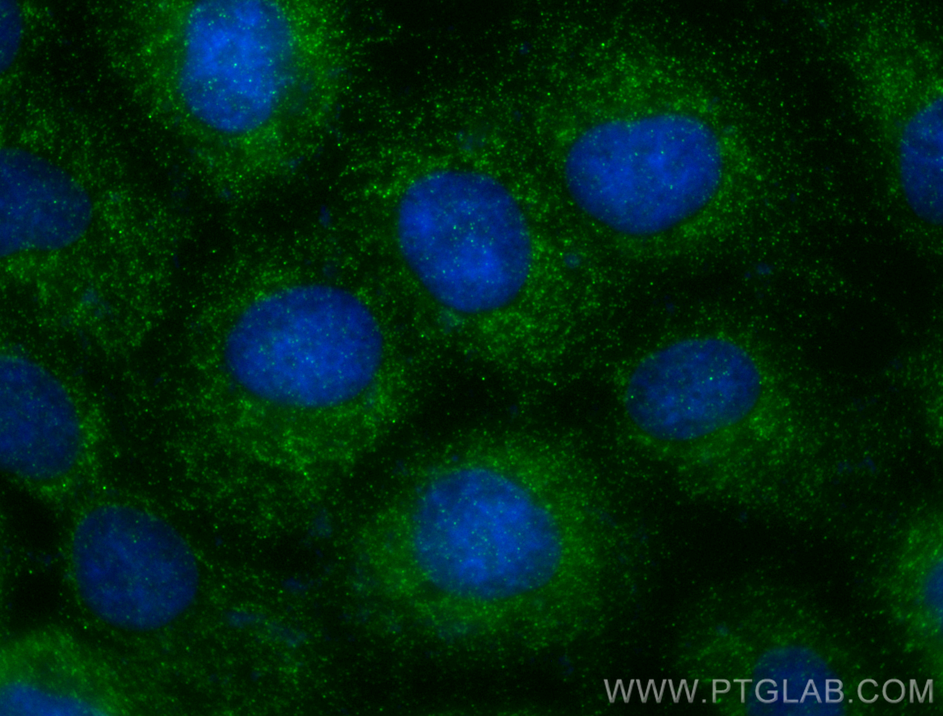 Immunofluorescence (IF) / fluorescent staining of A431 cells using KLK7 Polyclonal antibody (23810-1-AP)