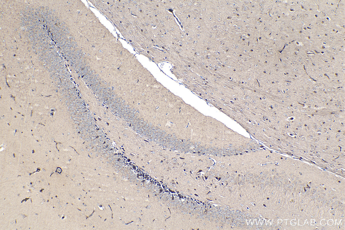 Immunohistochemistry (IHC) staining of mouse brain tissue using KLK8 Monoclonal antibody (68247-1-Ig)