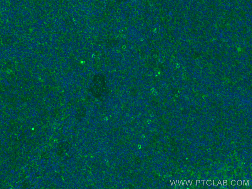 Immunofluorescence (IF) / fluorescent staining of human tonsillitis tissue using NKG2A Polyclonal antibody (10935-1-AP)