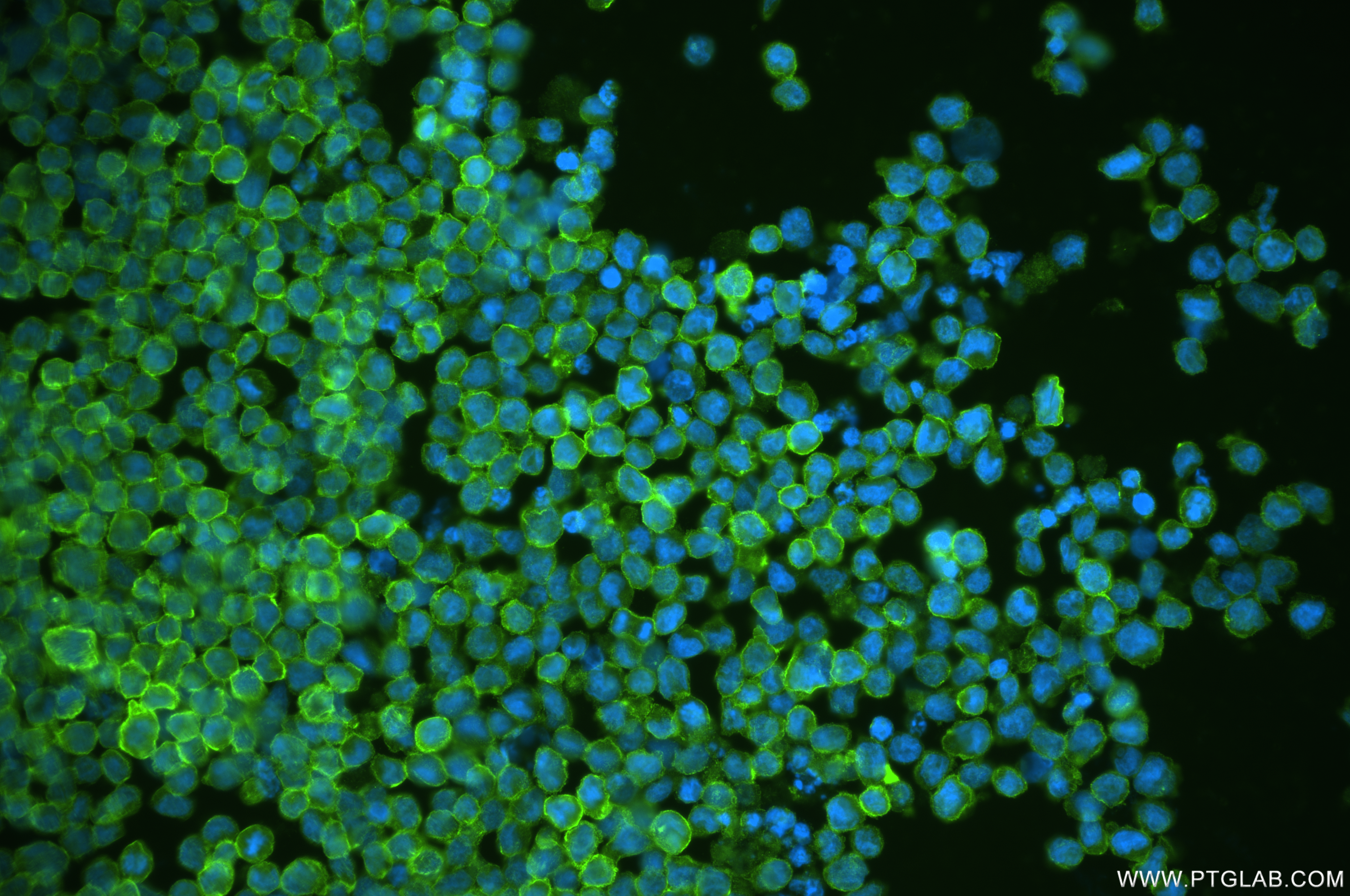 Immunofluorescence (IF) / fluorescent staining of NK-92 cells using CD94 Recombinant antibody (84466-5-RR)