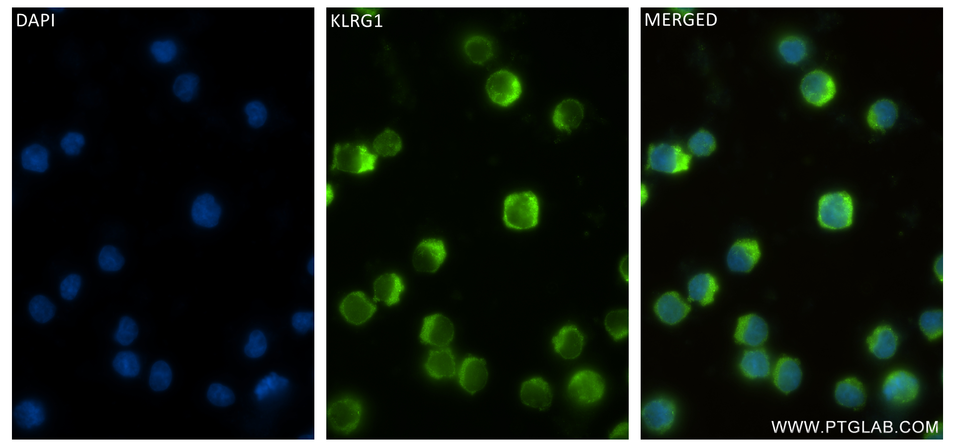 Immunofluorescence (IF) / fluorescent staining of Jurkat cells using KLRG1 Recombinant antibody (84785-5-RR)