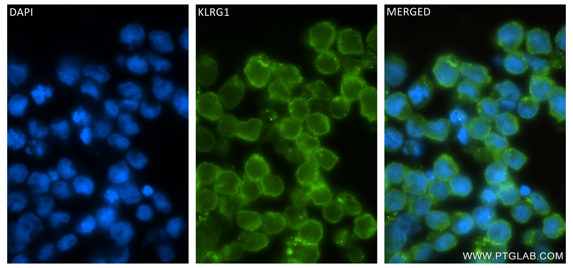 Immunofluorescence (IF) / fluorescent staining of NK-92 cells using KLRG1 Recombinant antibody (84785-5-RR)