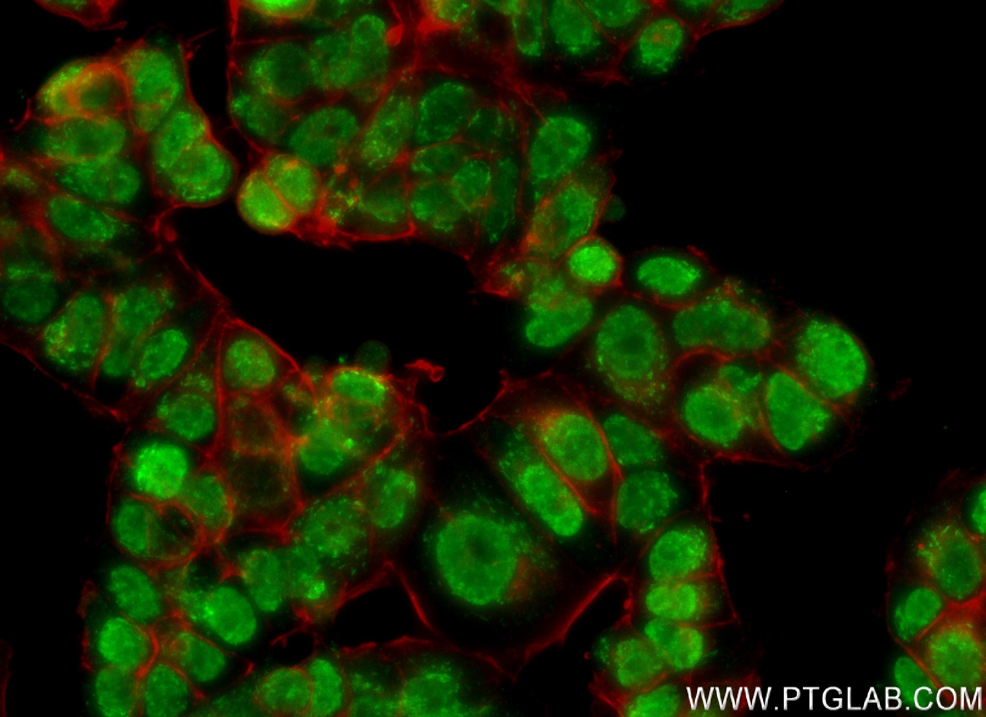 Immunofluorescence (IF) / fluorescent staining of MCF-7 cells using KMT2C Recombinant antibody (83595-4-RR)