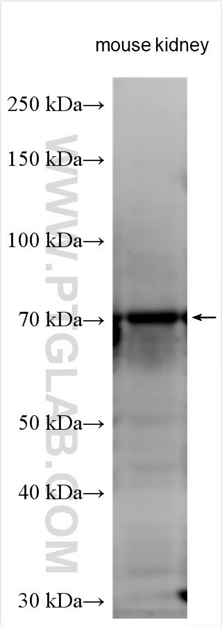 Western Blot (WB) analysis of various lysates using Kininogen 1 Polyclonal antibody (11926-1-AP)