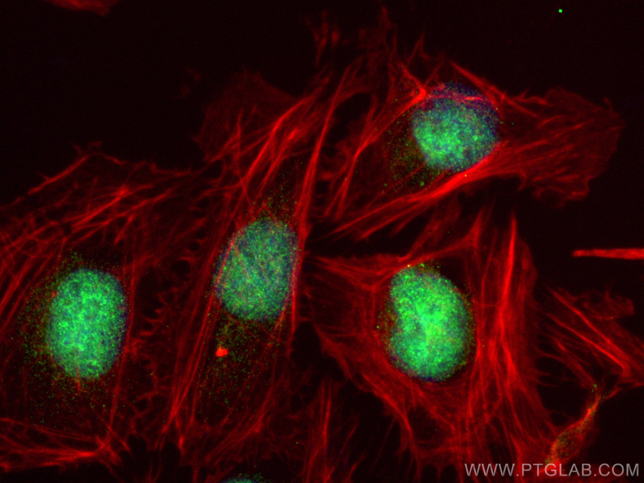 Immunofluorescence (IF) / fluorescent staining of U2OS cells using KNL1 Polyclonal antibody (28695-1-AP)