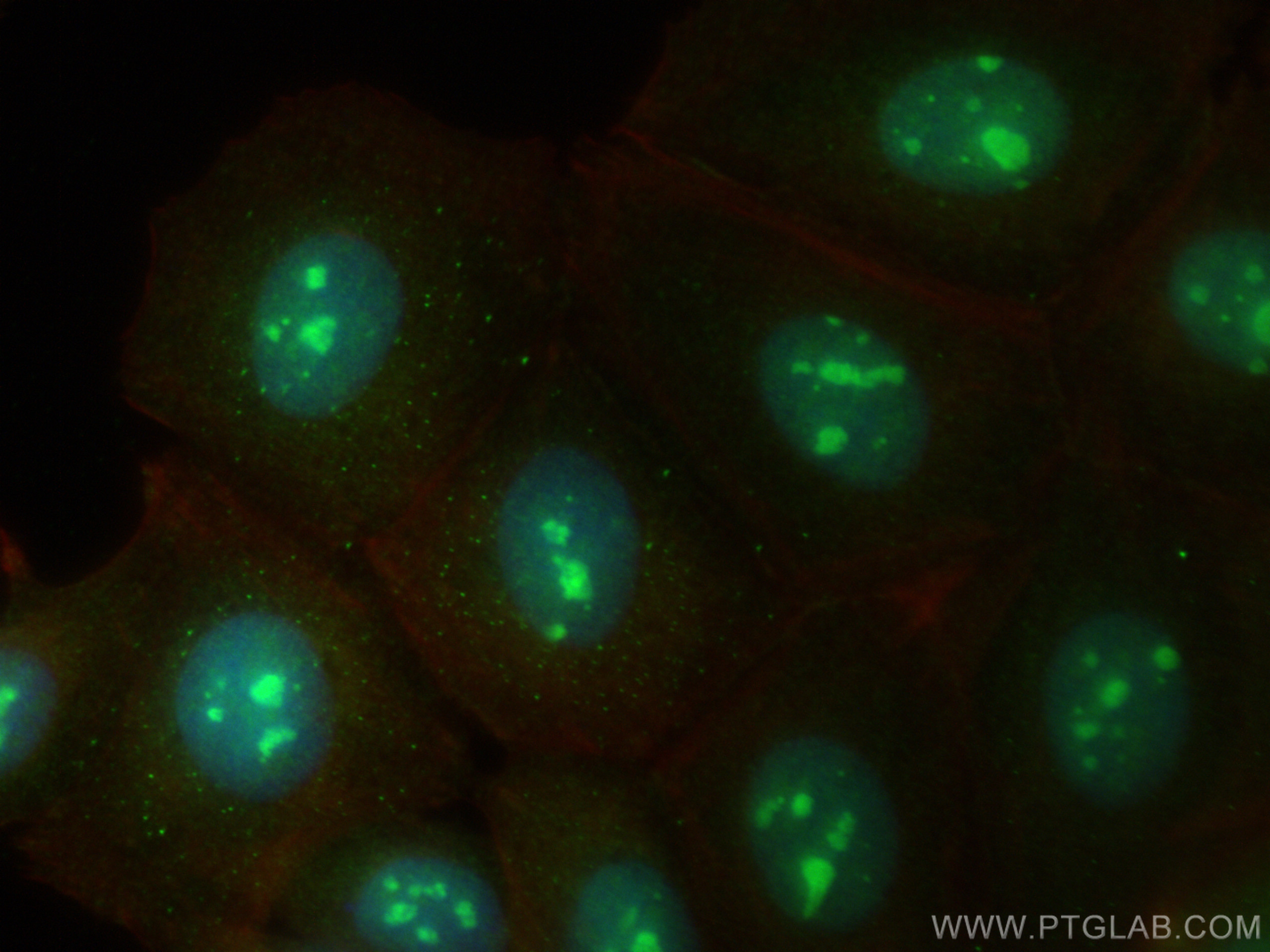 Immunofluorescence (IF) / fluorescent staining of MCF-7 cells using KNOP1 Polyclonal antibody (30115-1-AP)