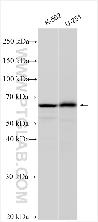 Western Blot (WB) analysis of various lysates using KNOP1 Polyclonal antibody (30115-1-AP)