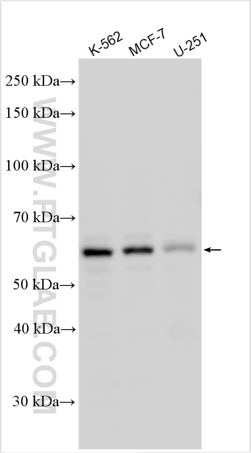 Western Blot (WB) analysis of various lysates using KNOP1 Polyclonal antibody (30115-1-AP)