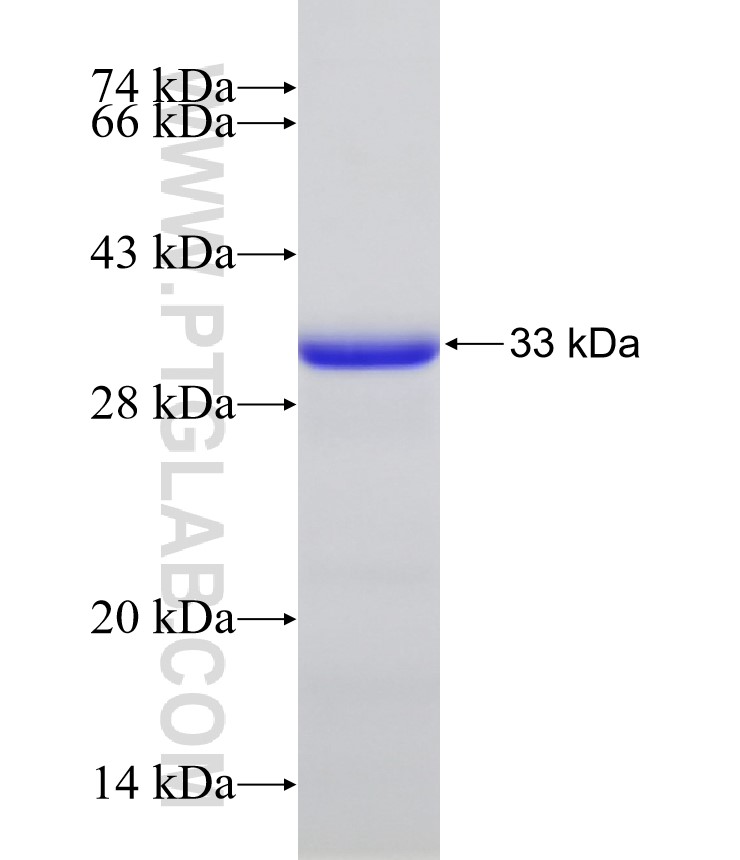 KNOP1 fusion protein Ag32395 SDS-PAGE