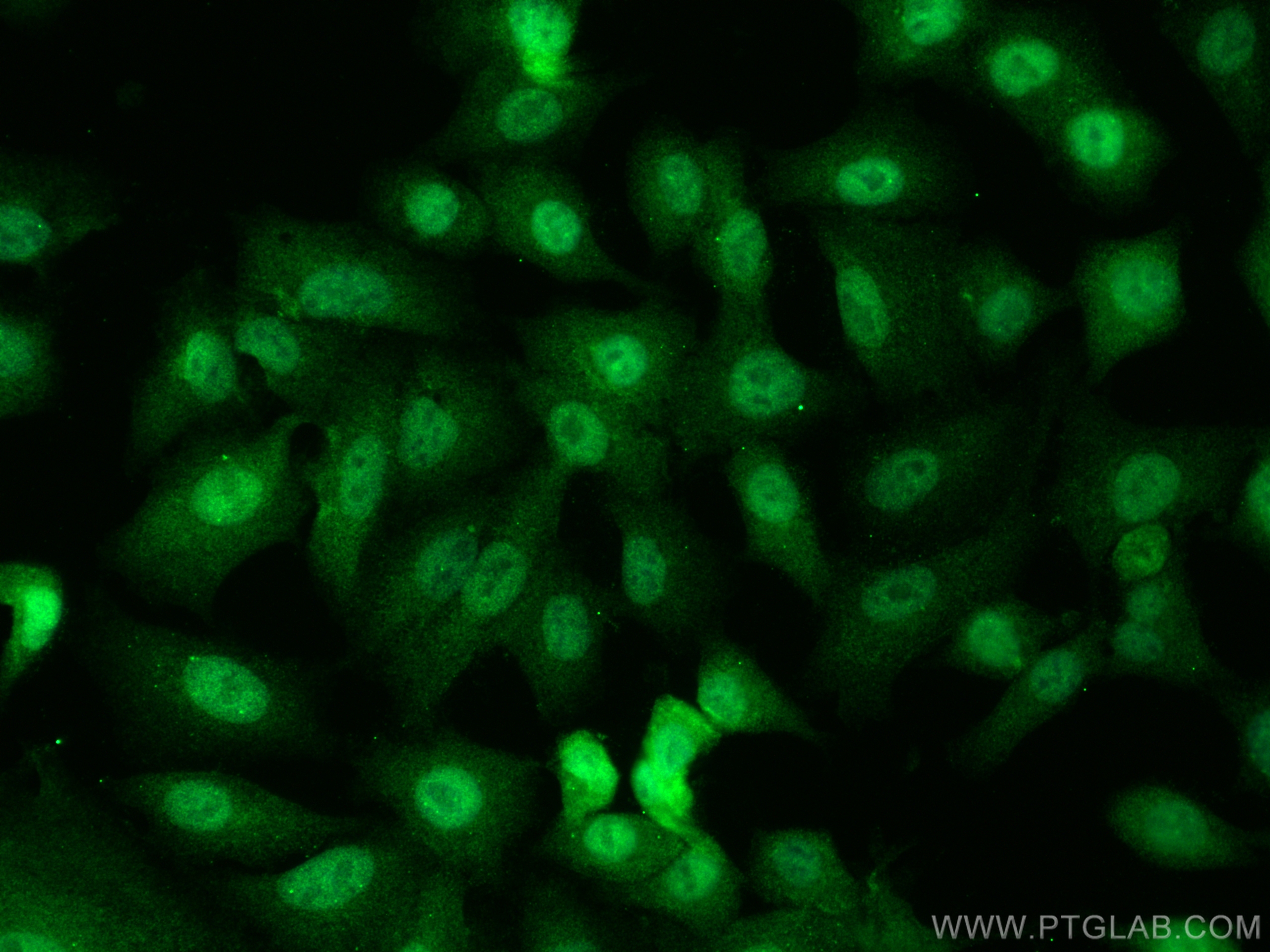 Immunofluorescence (IF) / fluorescent staining of A549 cells using KPNA4 Polyclonal antibody (12463-1-AP)