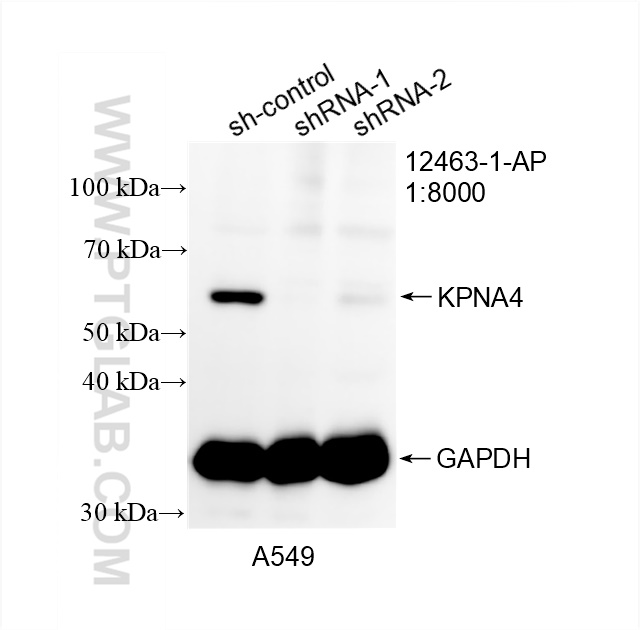 Western Blot (WB) analysis of A549 cells using KPNA4 Polyclonal antibody (12463-1-AP)