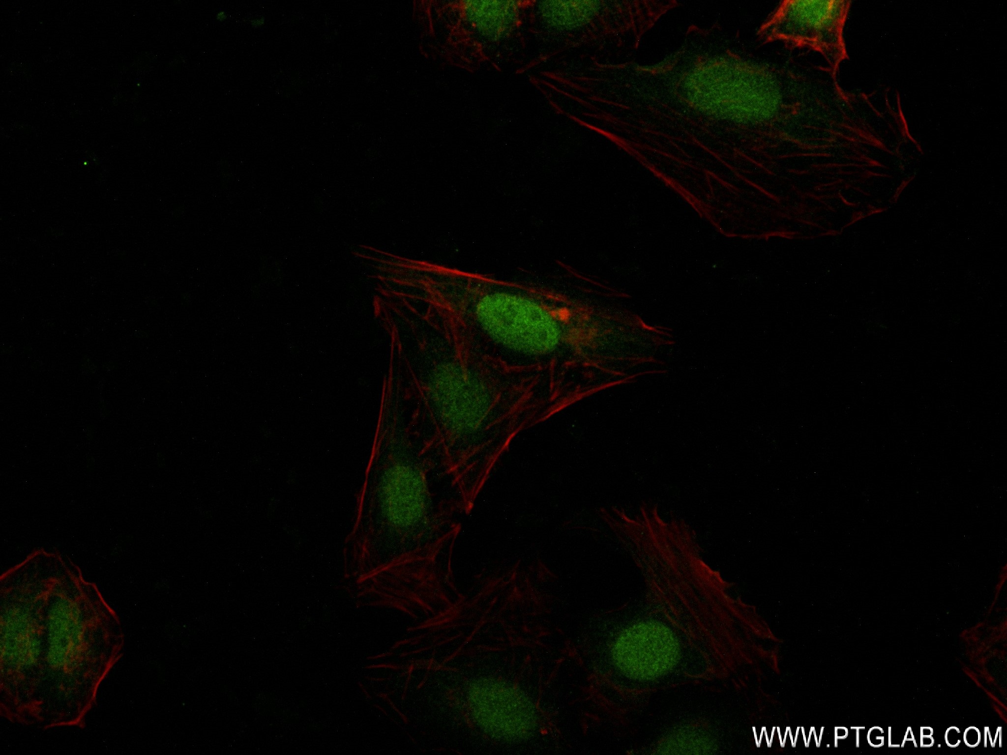 Immunofluorescence (IF) / fluorescent staining of U2OS cells using KPNA4 Recombinant antibody (82898-1-RR)