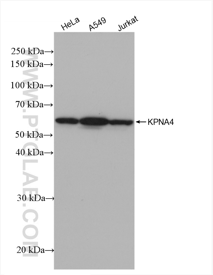 Western Blot (WB) analysis of various lysates using KPNA4 Recombinant antibody (82898-1-RR)