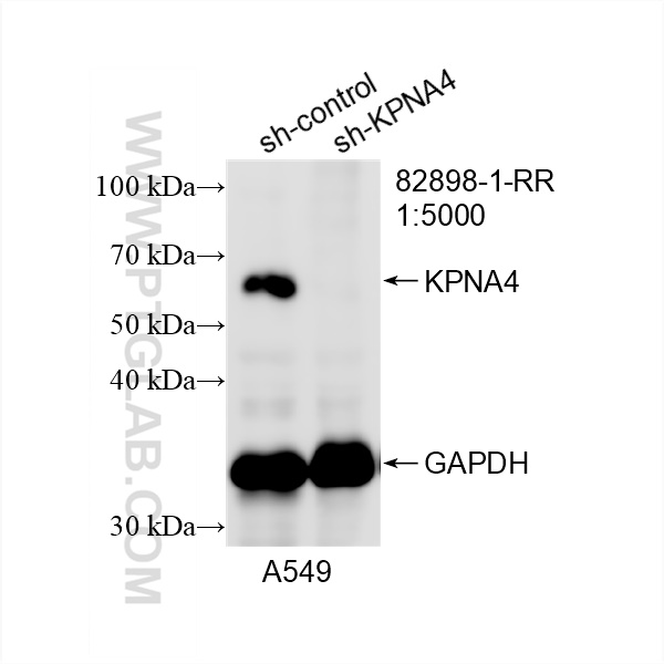 Western Blot (WB) analysis of A549 cells using KPNA4 Recombinant antibody (82898-1-RR)