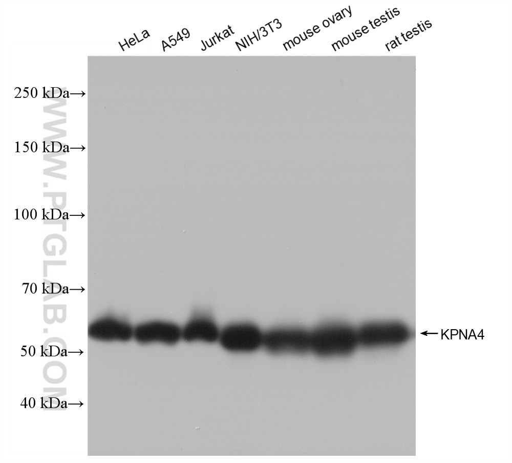 Western Blot (WB) analysis of various lysates using KPNA4 Recombinant antibody (82898-2-RR)