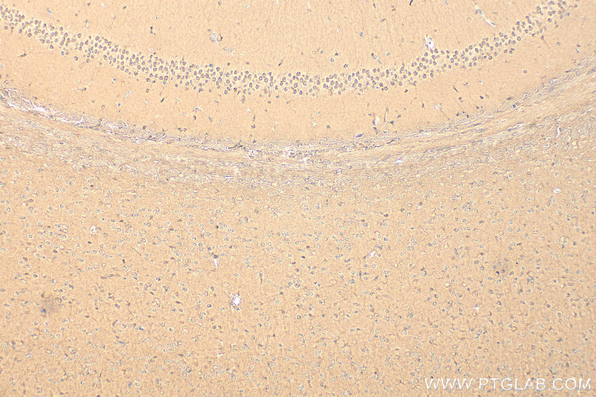 Immunohistochemistry (IHC) staining of mouse brain tissue using Importin Beta Polyclonal antibody (10077-1-AP)