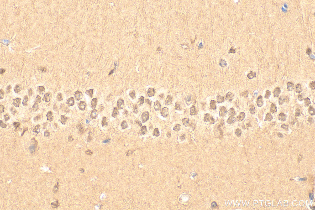 Immunohistochemistry (IHC) staining of mouse brain tissue using Importin Beta Polyclonal antibody (10077-1-AP)