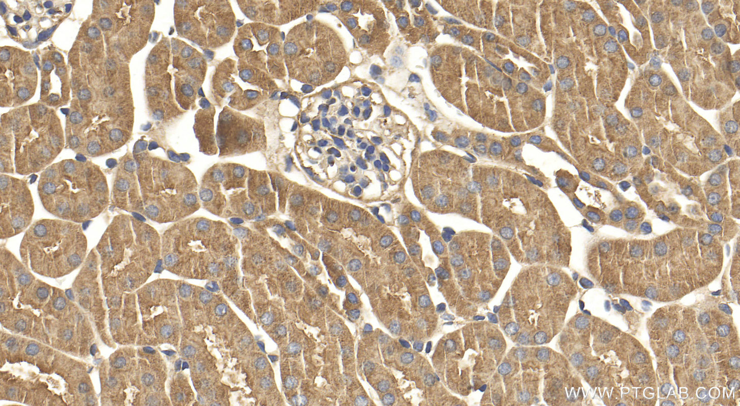 Immunohistochemistry (IHC) staining of mouse kidney tissue using KRAS Polyclonal antibody (12063-1-AP)