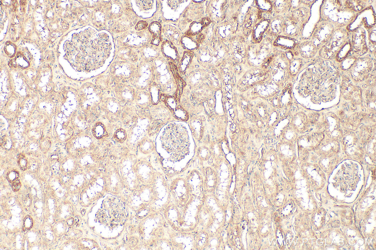 Immunohistochemistry (IHC) staining of human kidney tissue using KRAS Polyclonal antibody (12063-1-AP)
