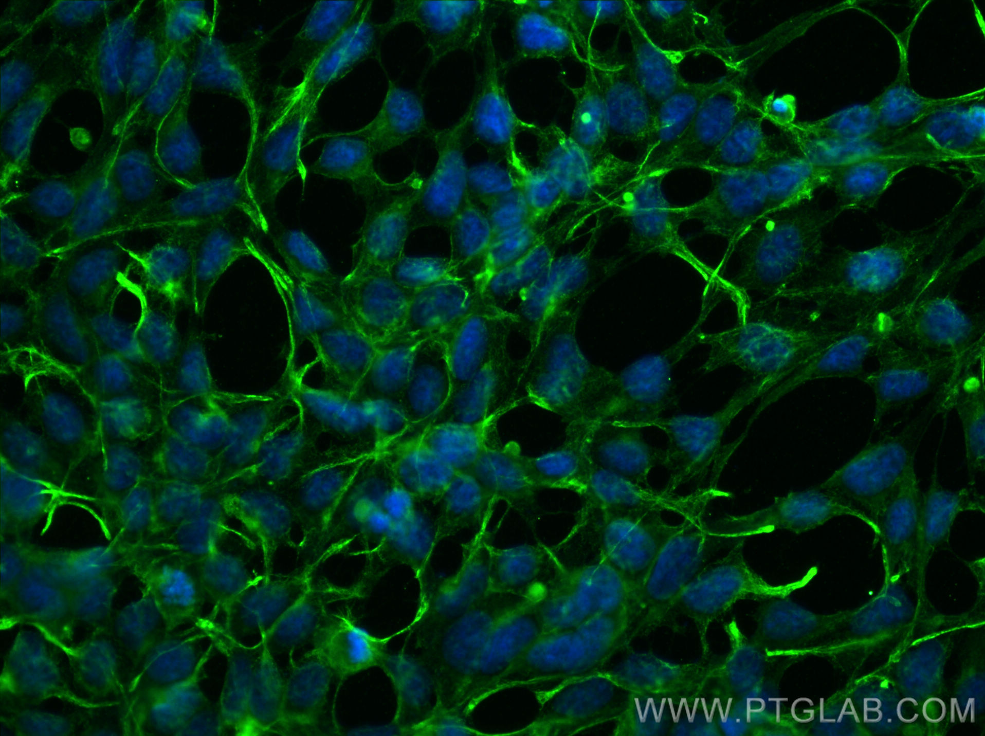 Immunofluorescence (IF) / fluorescent staining of HEK-293 cells using pan Ras Monoclonal antibody (60309-1-Ig)