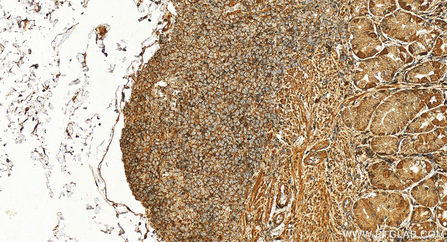 Immunohistochemistry (IHC) staining of human stomach tissue using KRAS-2A-specific Polyclonal antibody (16156-1-AP)