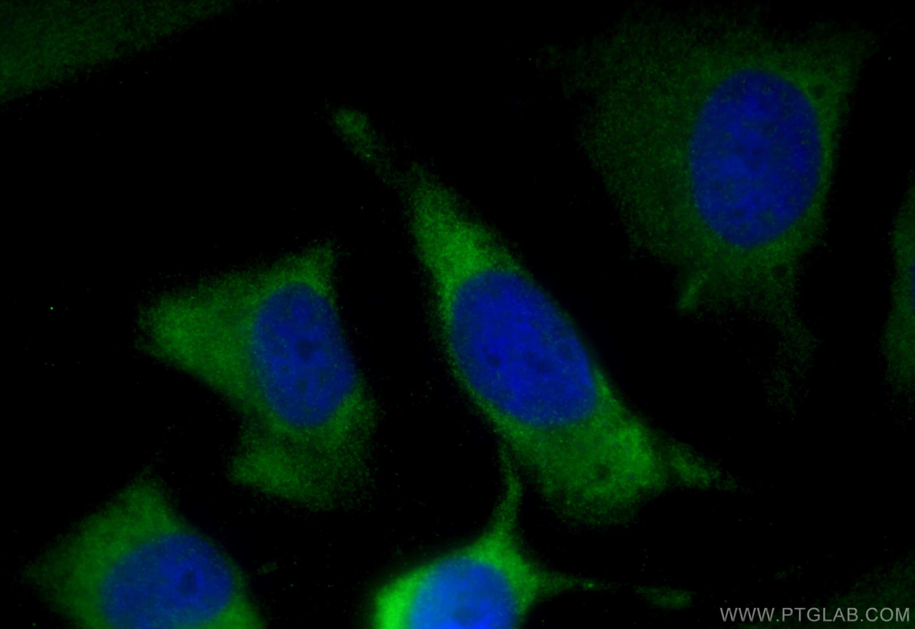 Immunofluorescence (IF) / fluorescent staining of HeLa cells using KRAS-2A-specific Polyclonal antibody (16156-1-AP)