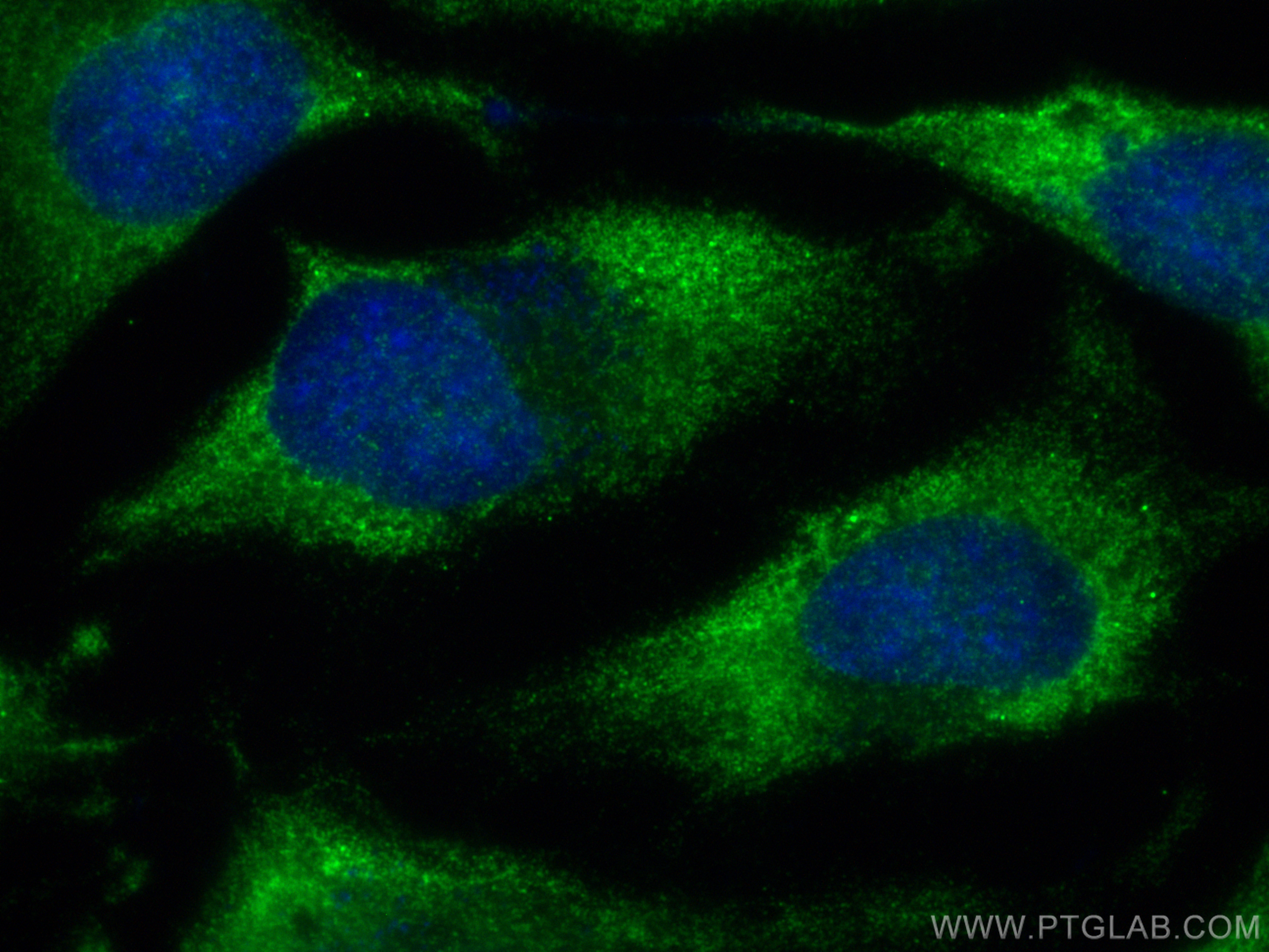 Immunofluorescence (IF) / fluorescent staining of HeLa cells using KRAS-2B Polyclonal antibody (16155-1-AP)