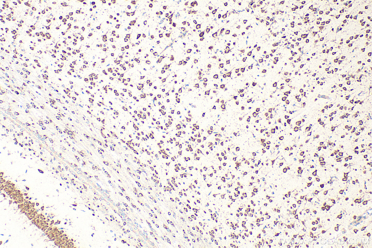 Immunohistochemistry (IHC) staining of rat brain tissue using KRAS-4B-specific Polyclonal antibody (16155-1-AP)