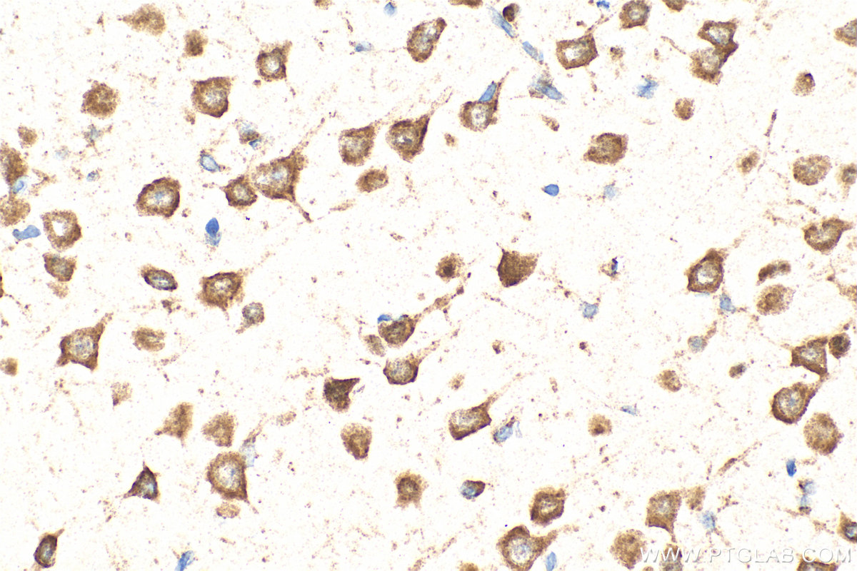 Immunohistochemistry (IHC) staining of rat brain tissue using KRAS-4B-specific Polyclonal antibody (16155-1-AP)