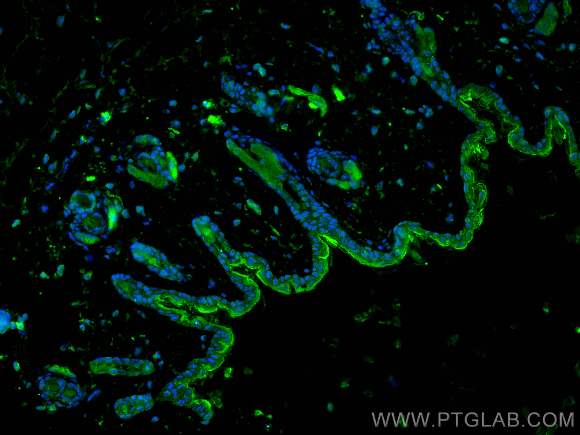 Immunofluorescence (IF) / fluorescent staining of mouse skin tissue using Cytokeratin 1-specific Polyclonal antibody (16848-1-AP)