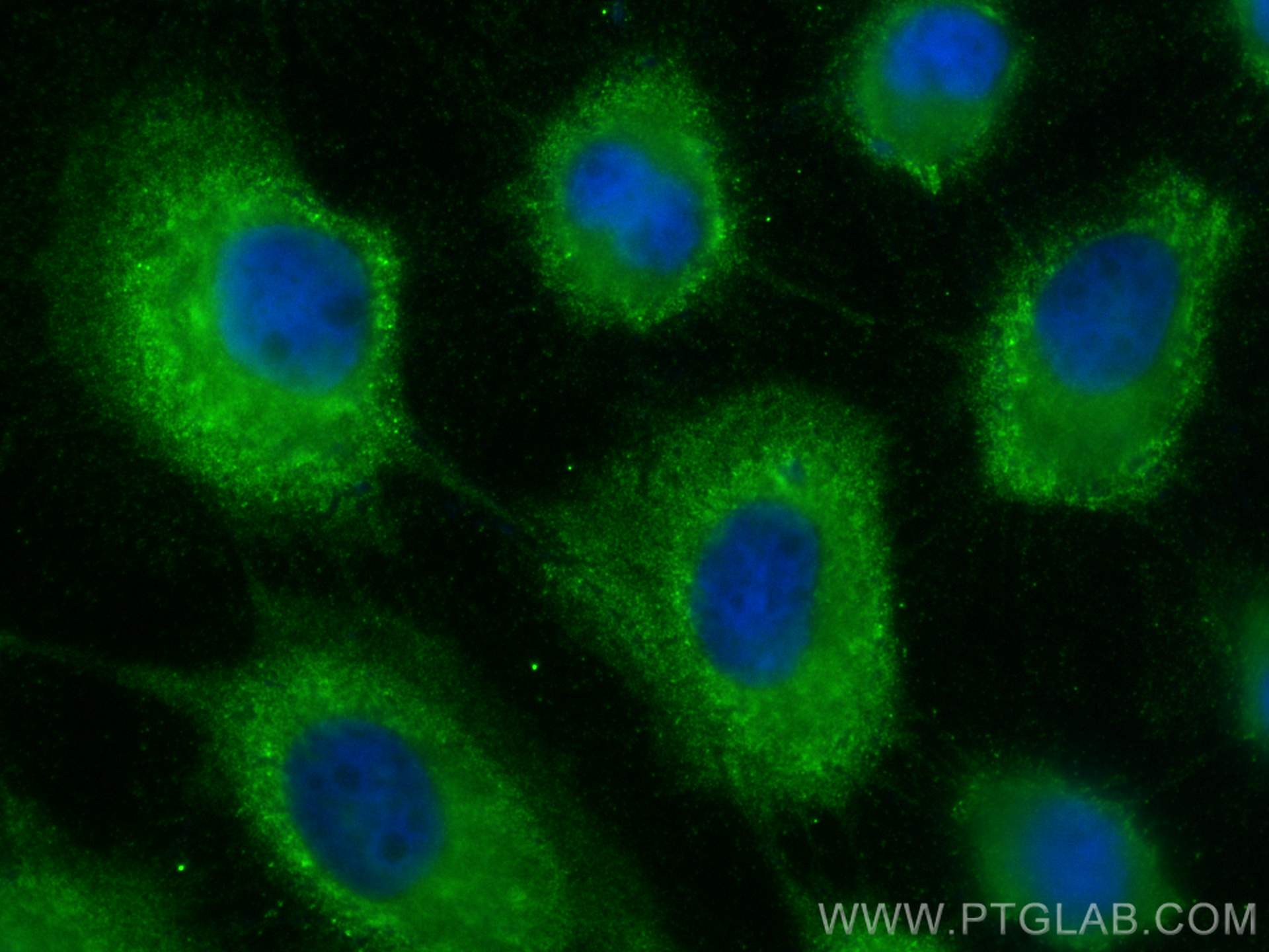 Immunofluorescence (IF) / fluorescent staining of A431 cells using Cytokeratin 1-specific Polyclonal antibody (16848-1-AP)