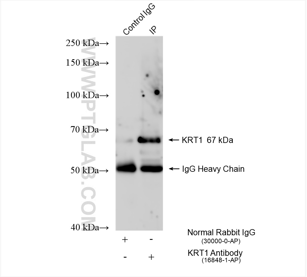 Immunoprecipitation (IP) experiment of mouse skin tissue using Cytokeratin 1-specific Polyclonal antibody (16848-1-AP)