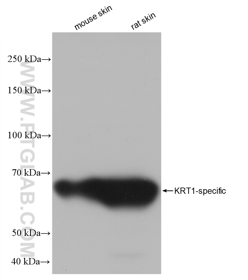 Western Blot (WB) analysis of various lysates using KRT1-specific Recombinant antibody (82972-1-RR)