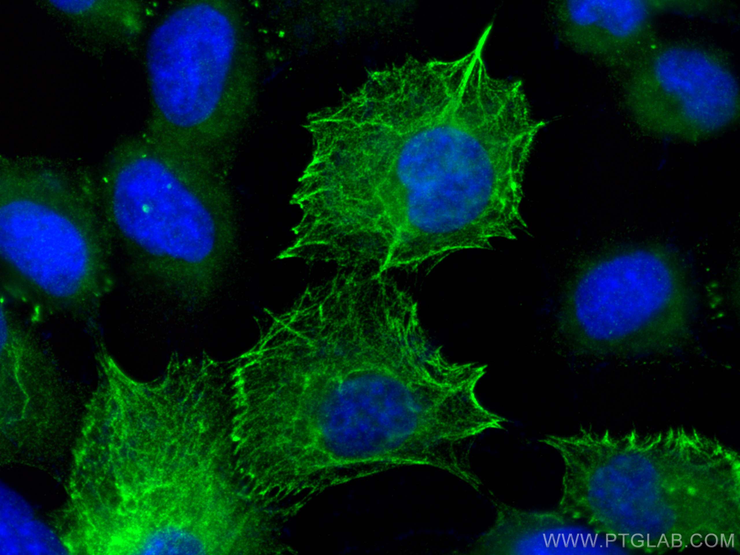 Immunofluorescence (IF) / fluorescent staining of A431 cells using Cytokeratin 10 Polyclonal antibody (18343-1-AP)