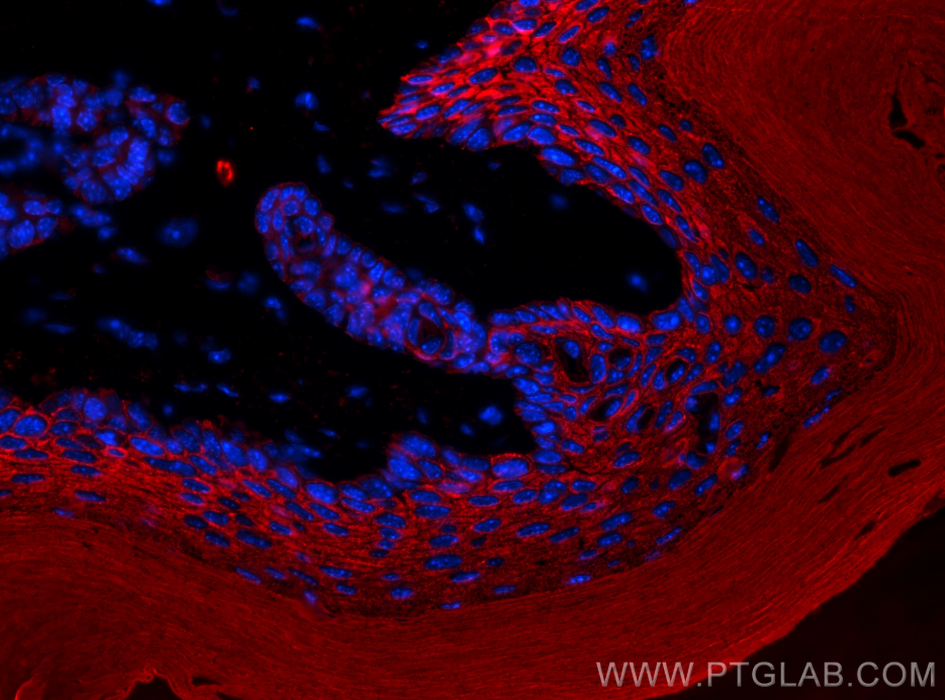 Immunofluorescence (IF) / fluorescent staining of mouse skin tissue using Cytokeratin 10 Polyclonal antibody (18343-1-AP)