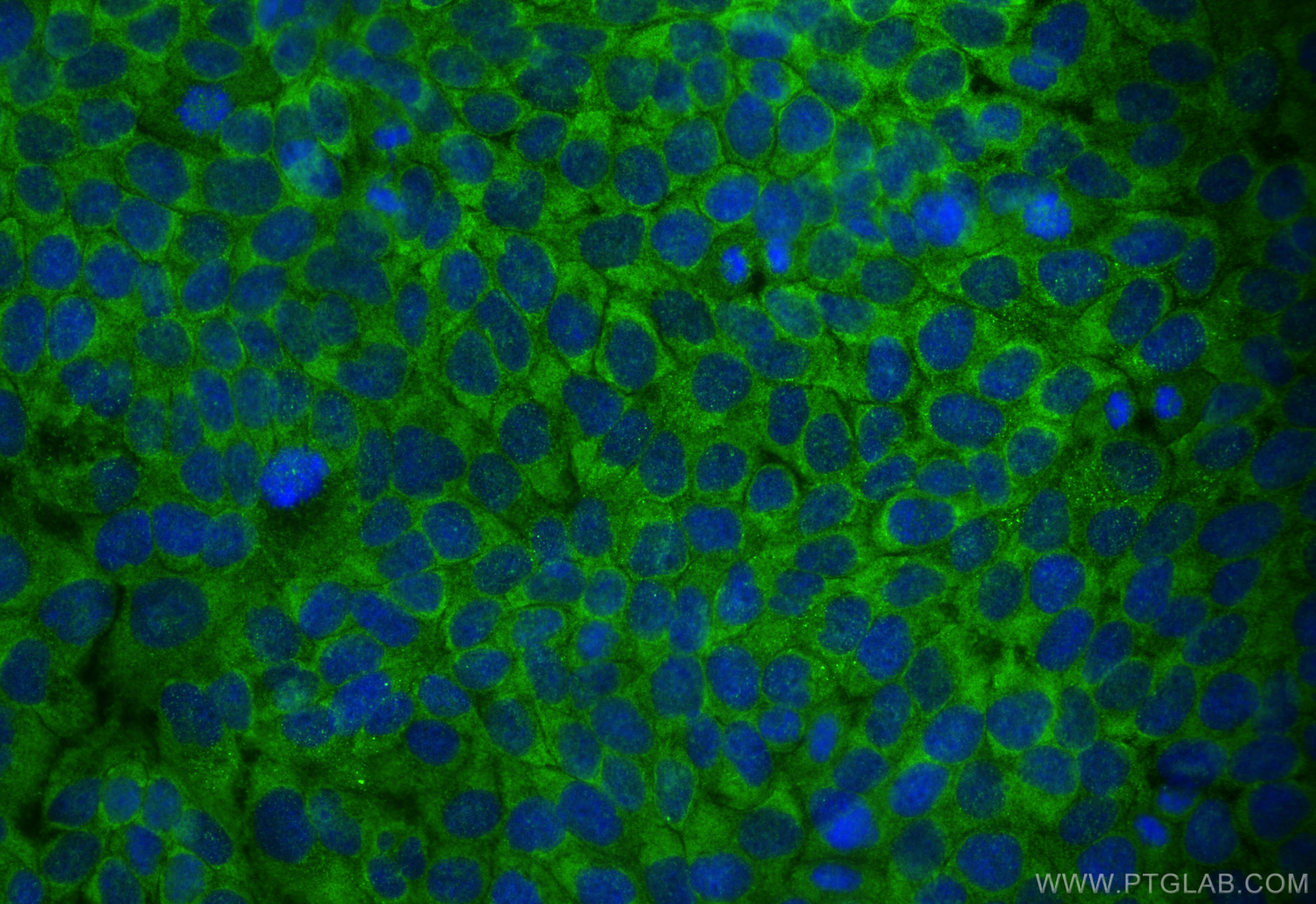 Immunofluorescence (IF) / fluorescent staining of HaCaT cells using Cytokeratin 10-specific Polyclonal antibody (16855-1-AP)