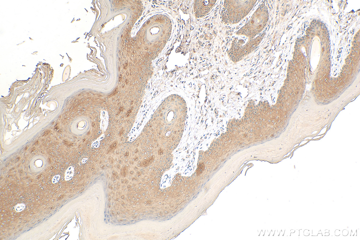 Immunohistochemistry (IHC) staining of rat skin tissue using Cytokeratin 10-specific Polyclonal antibody (16855-1-AP)