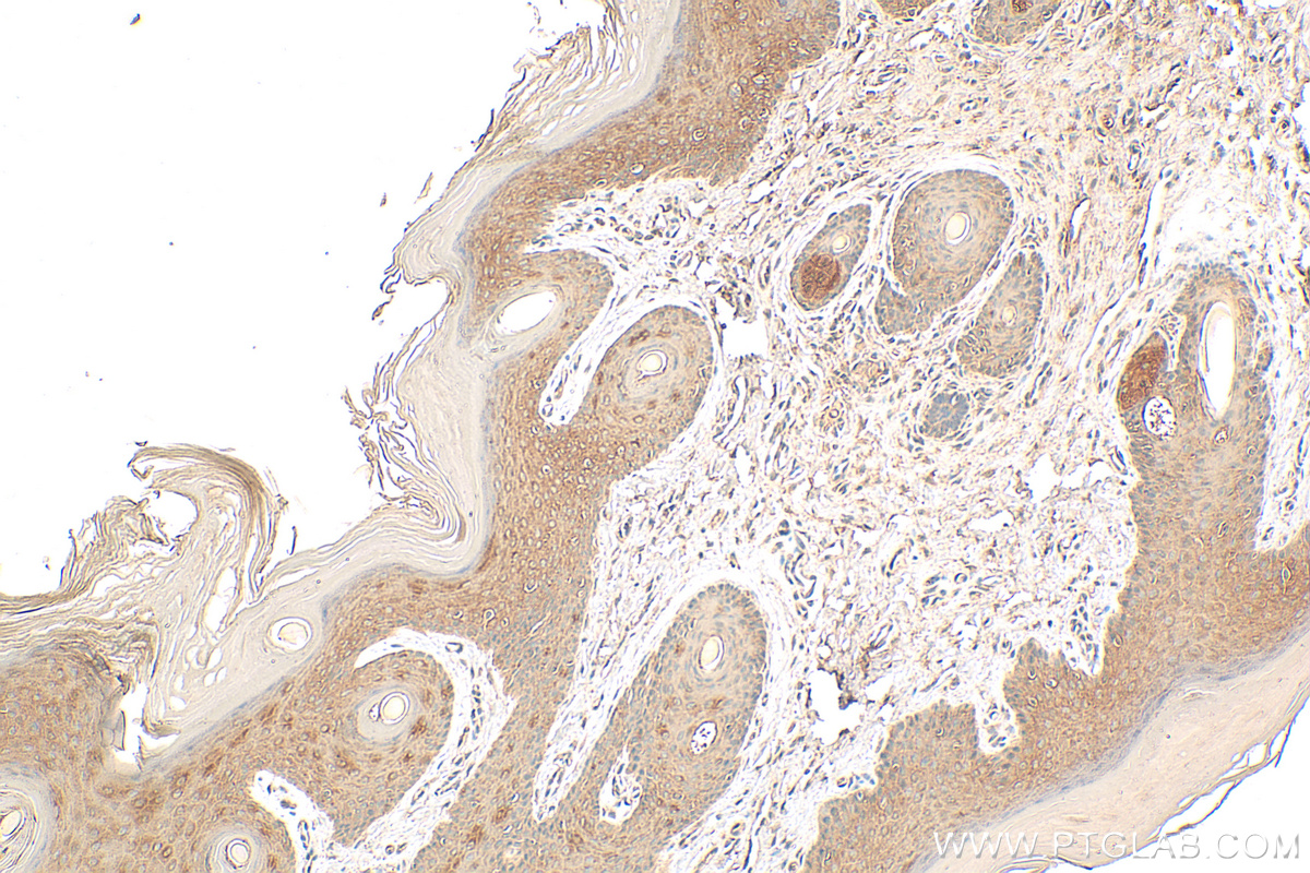 Immunohistochemistry (IHC) staining of rat skin tissue using Cytokeratin 10-specific Polyclonal antibody (16855-1-AP)