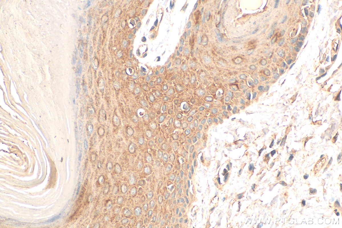 Immunohistochemistry (IHC) staining of rat skin tissue using Cytokeratin 10-specific Polyclonal antibody (16855-1-AP)