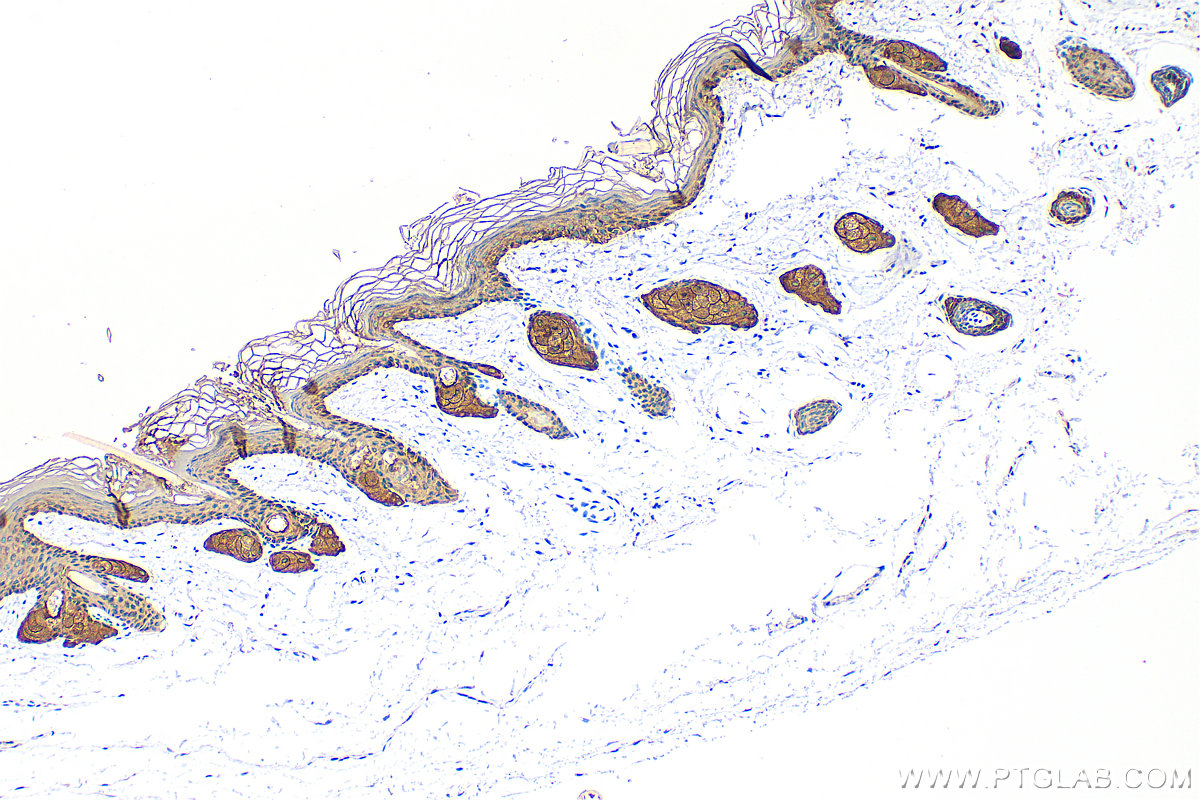 Immunohistochemistry (IHC) staining of mouse skin tissue using Cytokeratin 14 Polyclonal antibody (10143-1-AP)