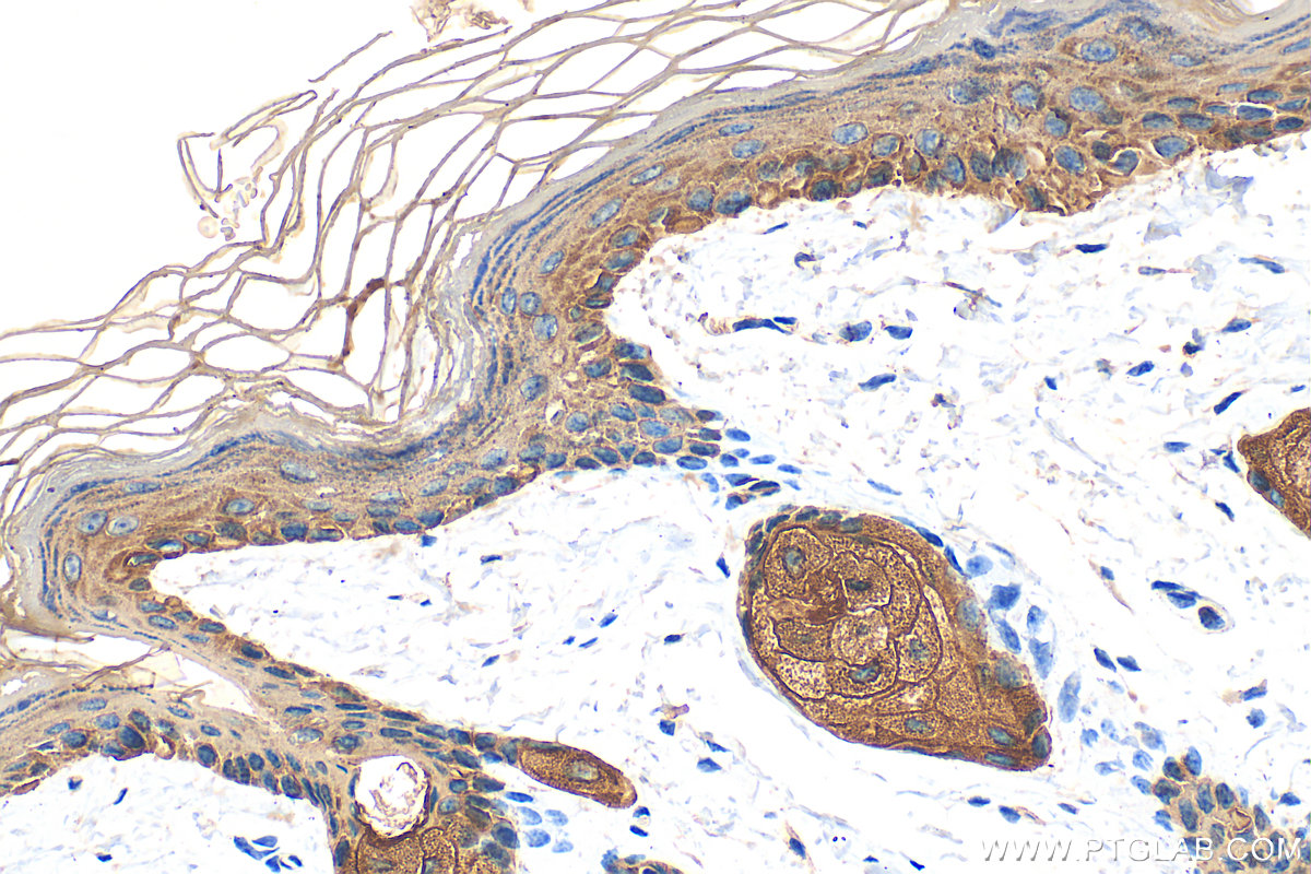 Immunohistochemistry (IHC) staining of mouse skin tissue using Cytokeratin 14 Polyclonal antibody (10143-1-AP)