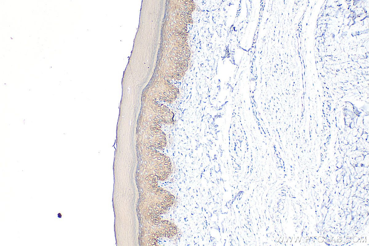 Immunohistochemistry (IHC) staining of rat skin tissue using Cytokeratin 14 Polyclonal antibody (10143-1-AP)