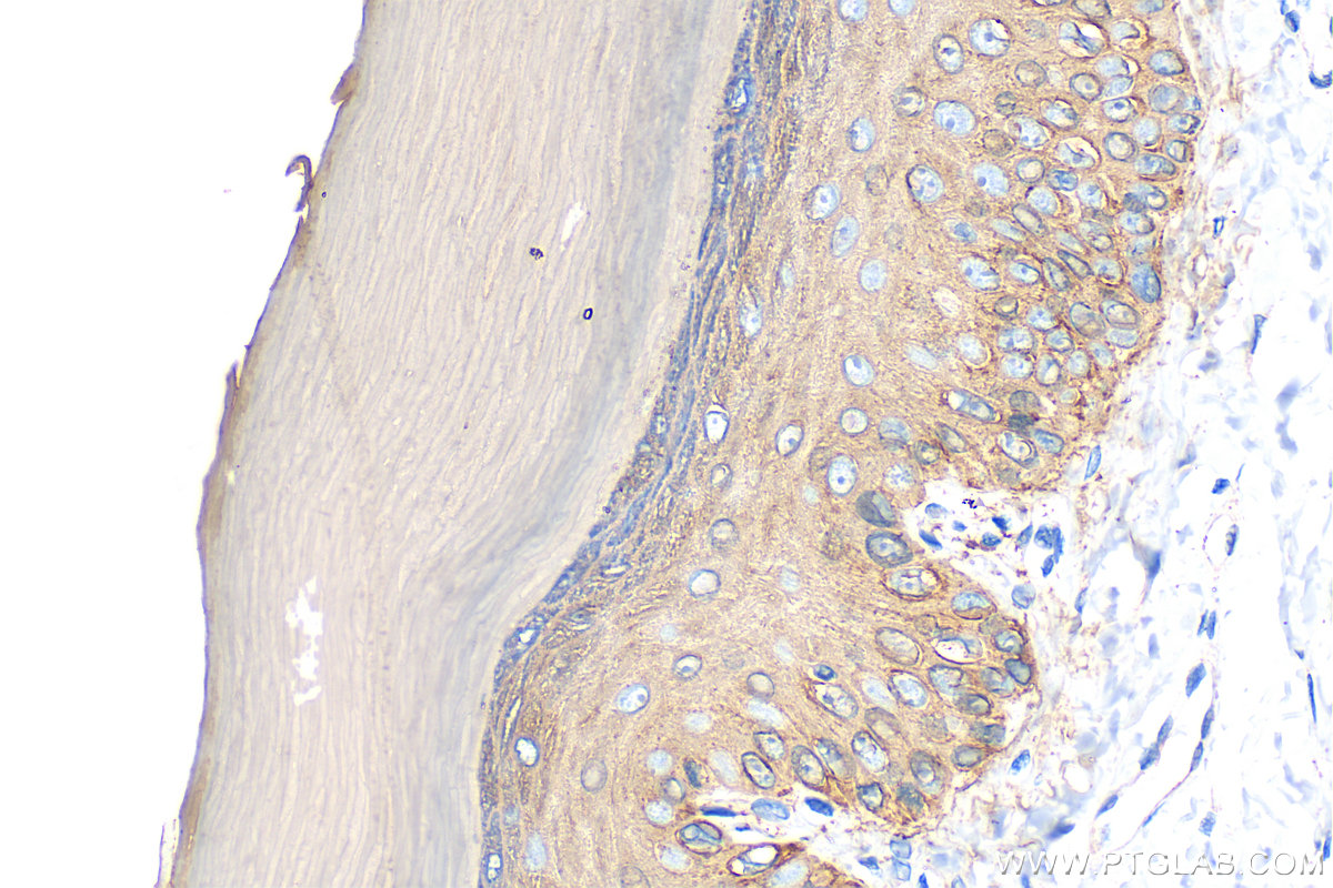 Immunohistochemistry (IHC) staining of rat skin tissue using Cytokeratin 14 Polyclonal antibody (10143-1-AP)