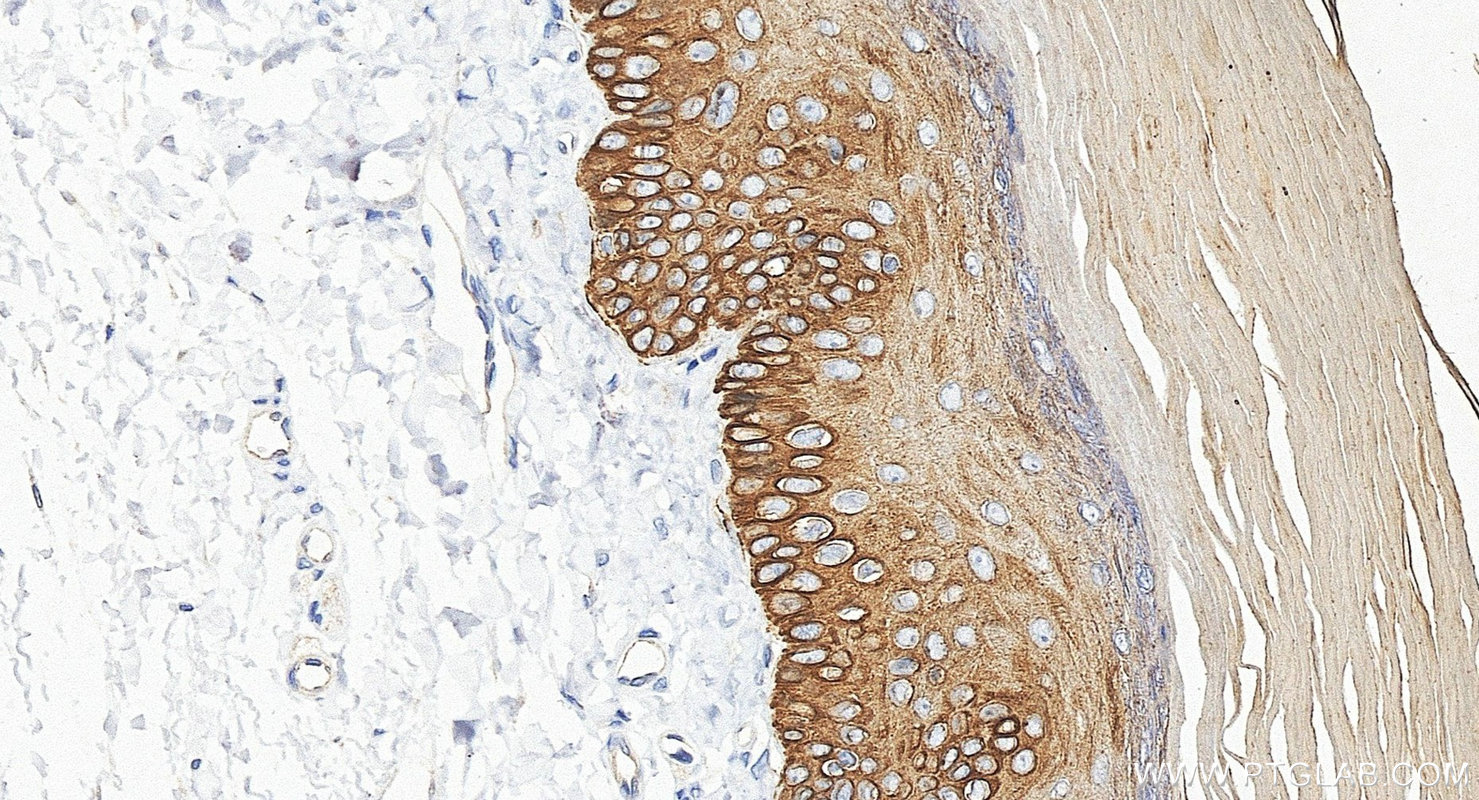 Immunohistochemistry (IHC) staining of rat skin tissue using Cytokeratin 14 Polyclonal antibody (10143-1-AP)