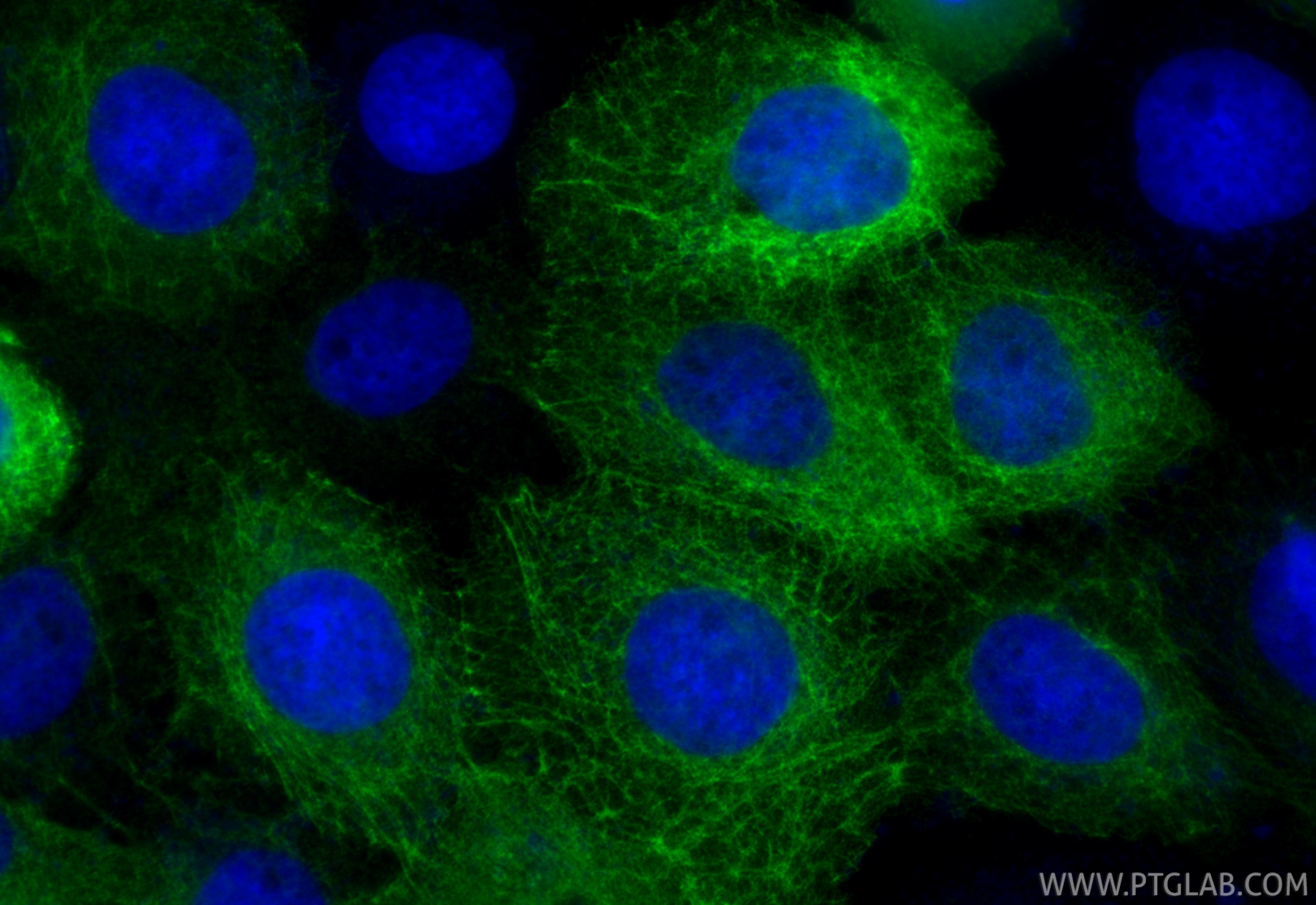 Immunofluorescence (IF) / fluorescent staining of A431 cells using Cytokeratin 15 Polyclonal antibody (10137-1-AP)
